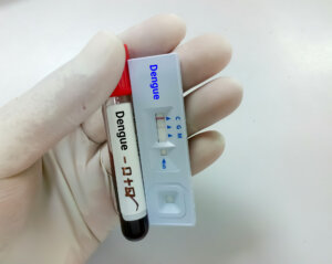 Close up view of technologist or technician glove hand hold a blood sample and rapid test cassette for dengue IgG, IgM rapid screening test